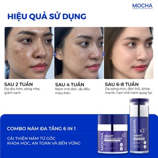 Combo Nám Đa Tầng Mocha & Retinol Mix Peel Hỗ Trợ Cải Thiện Nám Chuyên Sâu, Giúp Da Mịn Màng