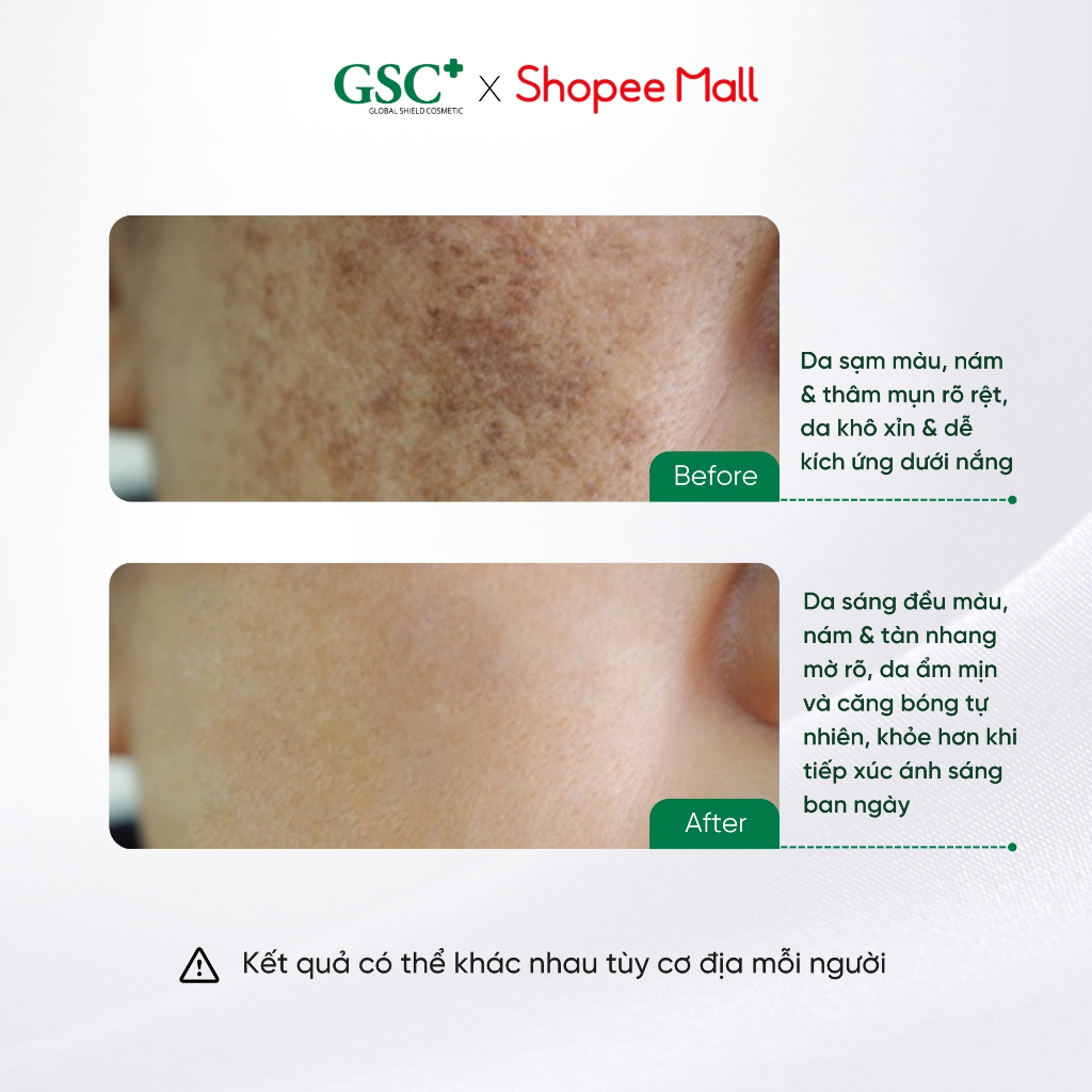 Serum Dưỡng Trắng Da Ban Ngày GSC Mela Bright Day 30ml Chuẩn Hàn Quốc – Giảm Nam, Làm Sáng, Bảo Vệ Da - GC097A