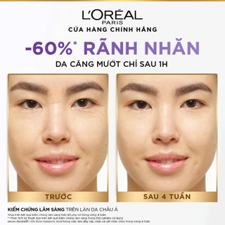 Bộ kem dưỡng ngày đêm chống rãnh nhăn lão hóa sớm 50mlx2, tẩy trang HA 95ml, serum 1.5% HA L'Oreal Paris 7.5ml