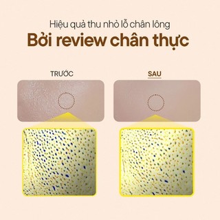 One-day's you - Toner Pad Làm Sạch - Help Me Pore-T Pad 60 Miếng  | Clycos Phân Phối