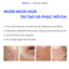 Kem phục hồi mụn SEVENLAB Brightening Anti-Acne Cream hỗ trợ làm lành và ngăn mụn tái phát 20gr