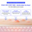 Kem phục hồi mụn SEVENLAB Brightening Anti-Acne Cream hỗ trợ làm lành và ngăn mụn tái phát 20gr