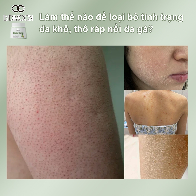 Sử dụng Tuýp Ô trong đời sống