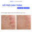 Gel chấm mụn SEVENLAB 15g giúp khô cồi mụn, làm dịu mụn viêm sau 12h hạn chế hình thành thâm sau mụn