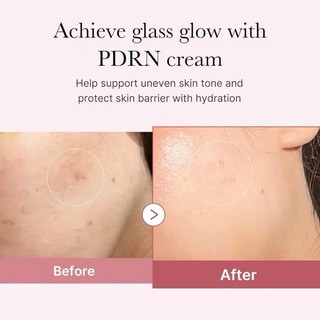 Medicube PDRN Pink Peptide Serum 30ml Dark Spots Glass Glow Collagen Barrier Brightening