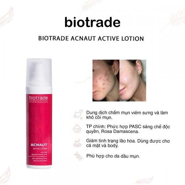 [ĐẠI LÝ CHÍNH HÃNG]Chấm mụn Biotrade Acnaut Active Cream/Lotion Giảm Mụn, Gom cồi 15ml[CÔNG TY] TẶNG 1 MÚT RỦA MẶT