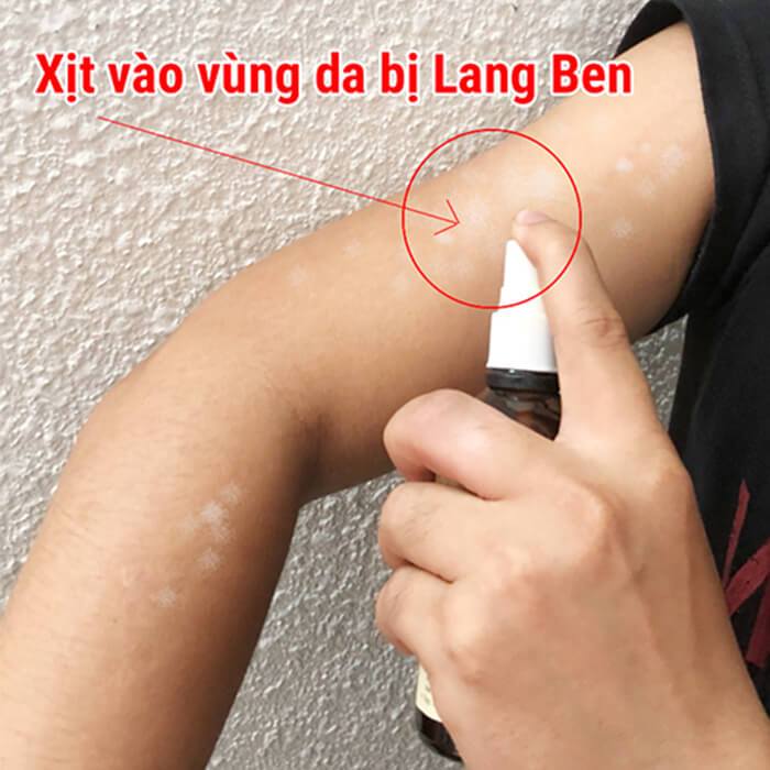 Hồng Sơn Xịt Nấm Lang Ben Hắc Lào Chai 50ml