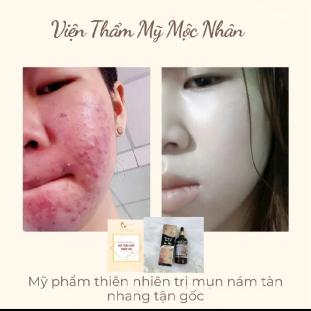 Chính Hãng Serum Linh Chi Tái Tạo Da Mộc Nhân Xóa Tan Mụn Nám Da không Đều Màu Lổ Chân Lông to