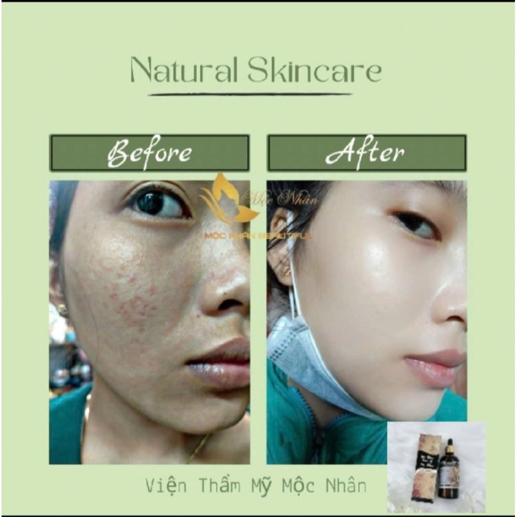 Chính Hãng Serum Linh Chi Tái Tạo Da Mộc Nhân Xóa Tan Mụn Nám Da không Đều Màu Lổ Chân Lông to