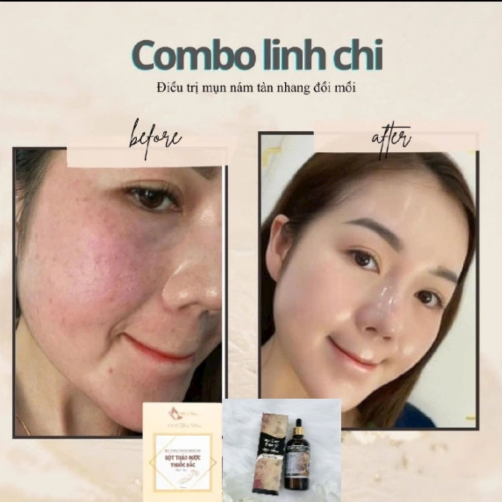 Chính Hãng Serum Linh Chi Tái Tạo Da Mộc Nhân Xóa Tan Mụn Nám Da không Đều Màu Lổ Chân Lông to