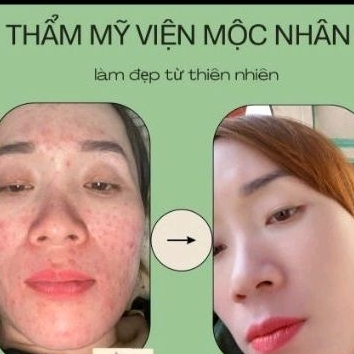 Chính Hãng Serum Linh Chi Tái Tạo Da Mộc Nhân Xóa Tan Mụn Nám Da không Đều Màu Lổ Chân Lông to