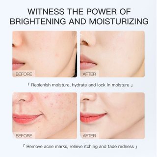 Mặt Nạ Trái Cây Gongpei Hàn Quốc SET 50 Miếng Dưỡng Ẩm Trắng Da, Cung Cấp Vitamin Nuôi Dưỡng Làn Da Trẻ Hoá Căng Mướt
