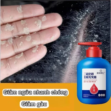 Selenium Sulfide Dầu gội dầu làm sạch sâu loại bỏ vũ giảm da đầu ngứa ， dầu gội dược liệu nấm da đầu, giảm ngứa