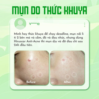Bộ sản phẩm gel giảm mụn nhanh 24h Hiruscar 10g và Sữa rửa mặt 100ml