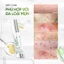 DAILY EFFECT Acne Spot Control Gel (5g & 10g)