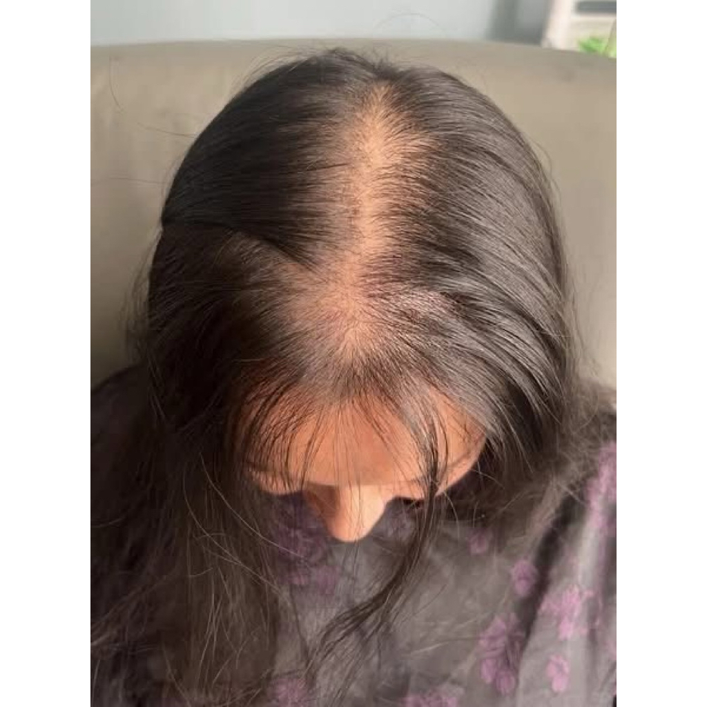 Thảo dược mọc tóc