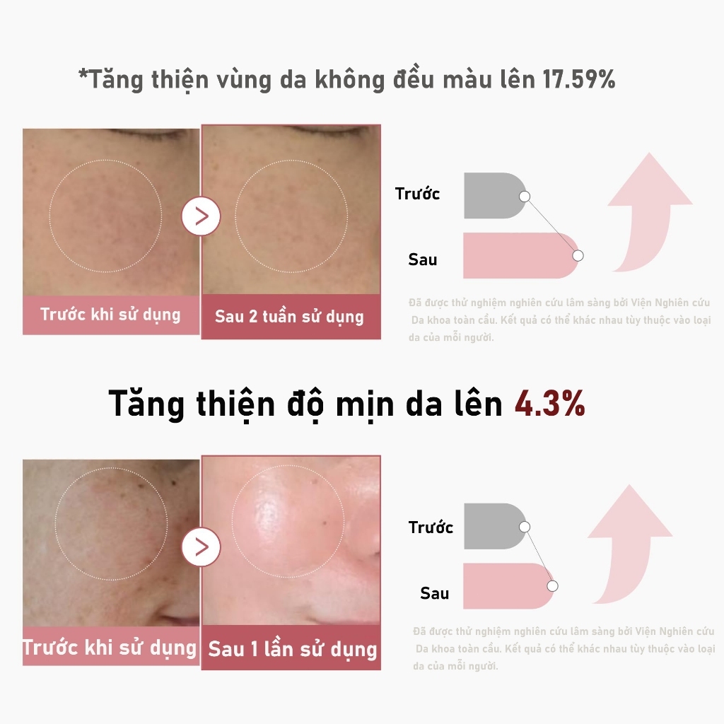 Serum Vi Gai Chống Lão Hoá Medicube PDRN Pink Collagen Exosome Shot 2000/7500 30ml