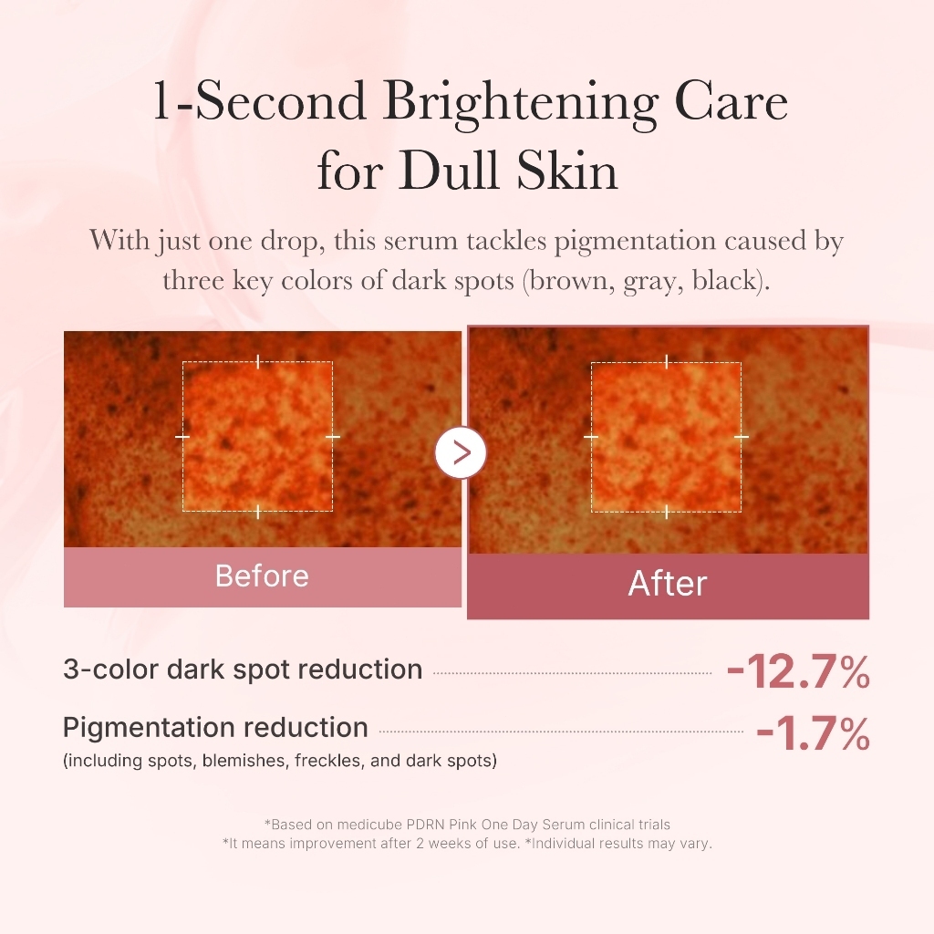 Hộp 10 Ống Tinh Chất Dưỡng Căng Bóng, Trẻ Hóa, Sáng Da Medicube PDRN Pink One Day Serum