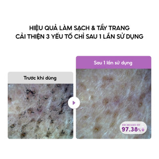 Dầu tẩy trang giảm mụn đầu đen EQQUALBERRY Purple Rice Pore Smoothing 200ml