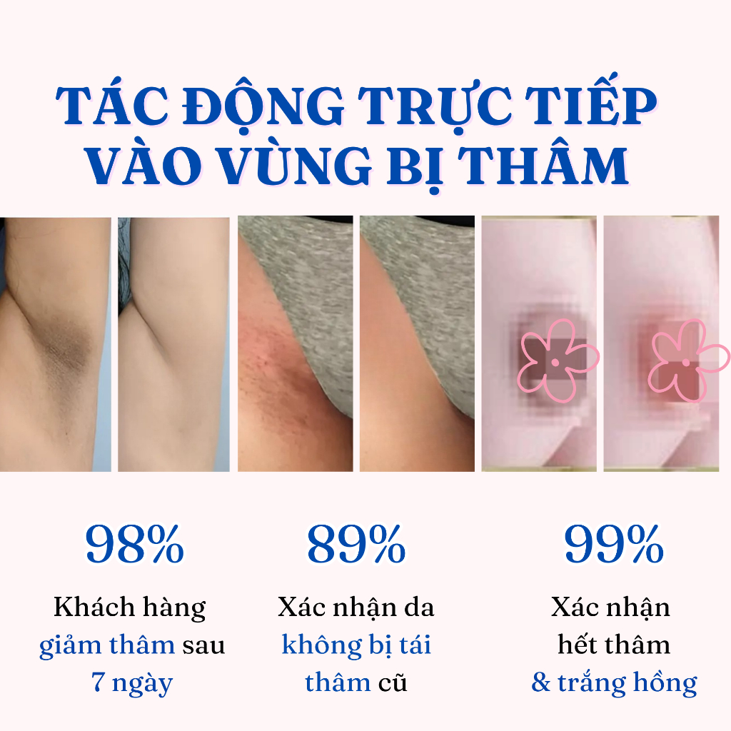 Kem Giảm Thâm Làm Hồng Nách, Nhũ Hoa, Mông, Bẹn, Đầu Gối Giúp Trắng, Mềm Mịn, Trẻ Hoá Vùng Da Nhạy Cảm