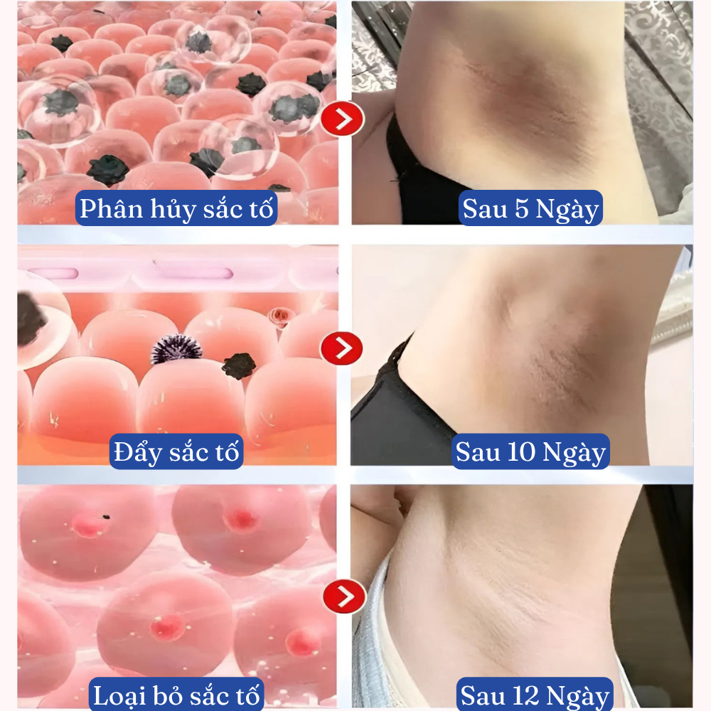Kem Giảm Thâm Làm Hồng Nách, Nhũ Hoa, Mông, Bẹn, Đầu Gối Giúp Trắng, Mềm Mịn, Trẻ Hoá Vùng Da Nhạy Cảm