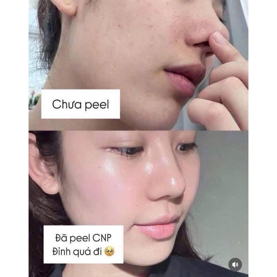 Peel Tái Tạo Da Chuyên Sâu 2ml – Hỗ Trợ Sáng Mịn & Ngăn Lão Hóa
