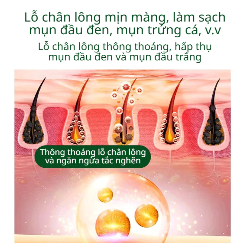 MẶT NẠ BỌT ANTHOCYANIN Mặt Nạ Bọt Thanh Lọc Da - Đánh Bay Mụn Đầu Đen, Mụn Ẩn & Mụn Trứng Cá Hiệu Quả | Làm Sạch Sâu, Th