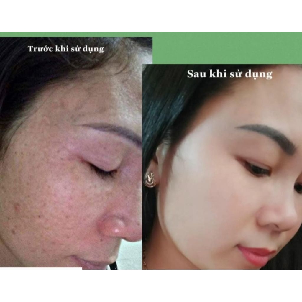 Bộ Đôi Sữa Rửa Mặt và Kem Face collagen HA Dưỡng Trắng Trẻ Hóa Ngừa Mụn Mộc Nhân