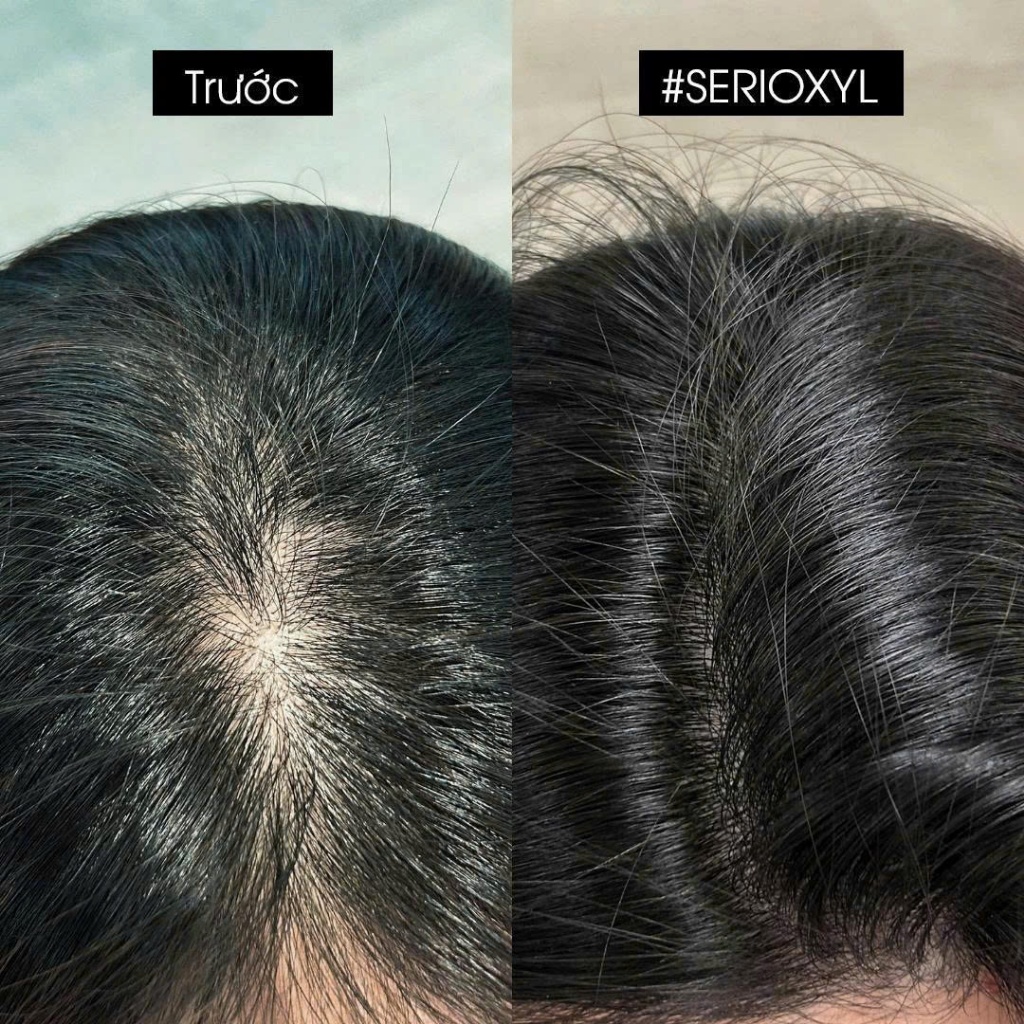 [GIFT] Dầu gội làm sạch tóc & giúp tóc trông dày hơn L'Oréal Professionnel Serioxyl Advanced 100ml
