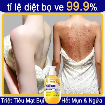 Sữa tắm mụn lưng sữa tắm viêm nang lông sữa tắm lưu huỳnh 500ml Làm sạch sâu bụi bẩn dưới da Cải thiện mụn trứn