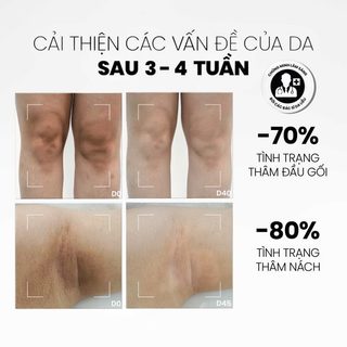Sữa Dưỡng Thể MD CARE Sáng Da Mờ Thâm Brightening Booster Body Lotion 200ml