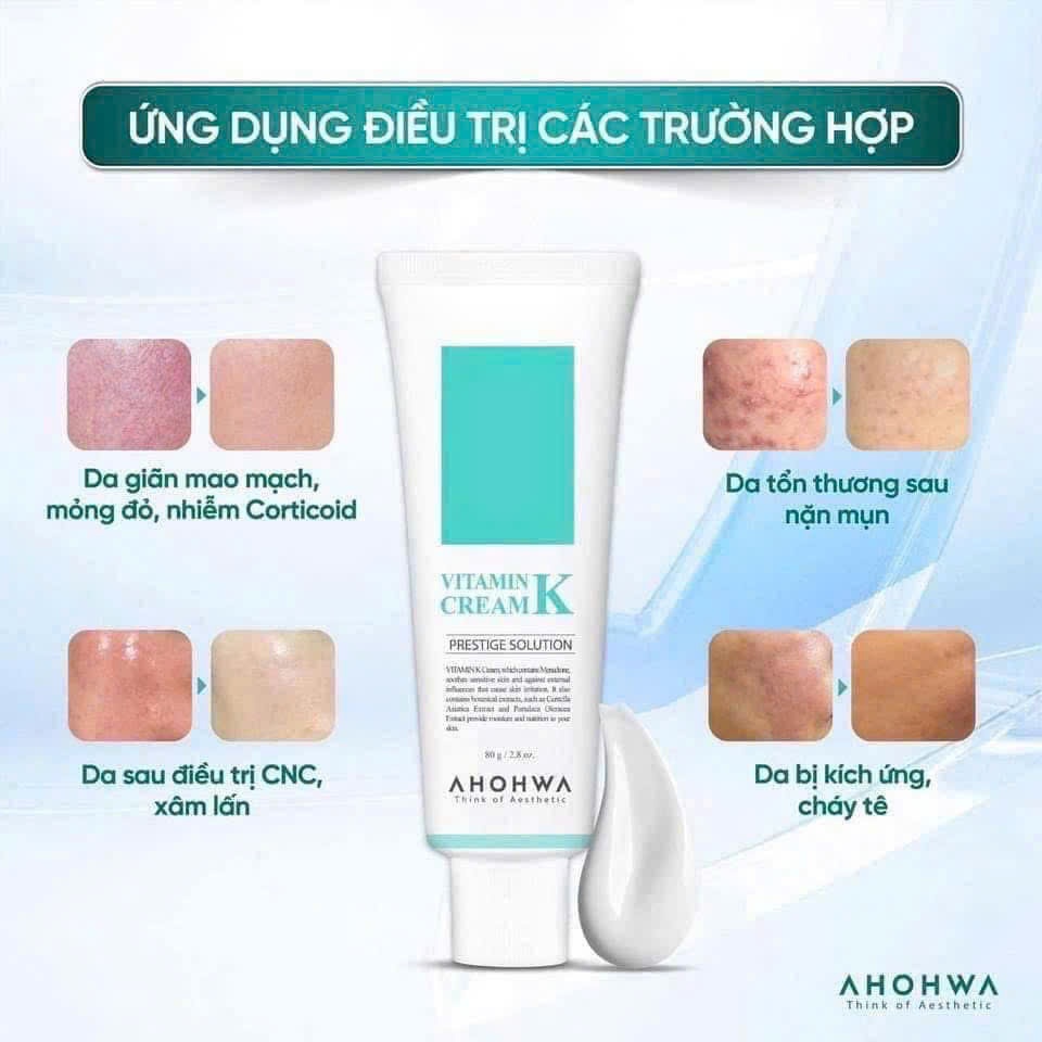 [ĐẠI LÝ CHÍNH HÃNG] Kem Dưỡng Phục Hồi Ahohwa Vitamin K Cream - Phục Hồi Da Mỏng Đỏ, Giãn Mao Mạch, Làm Dịu Da