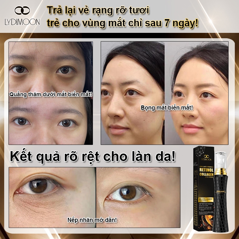 Kem Bôi Tiêu Chuẩn - Kem Chống Nhăn Mắt Kem Retinol Mắt Giảm Thâmắt Kem Dưỡng Mắt 20G Giảm Nếp Nhăn
