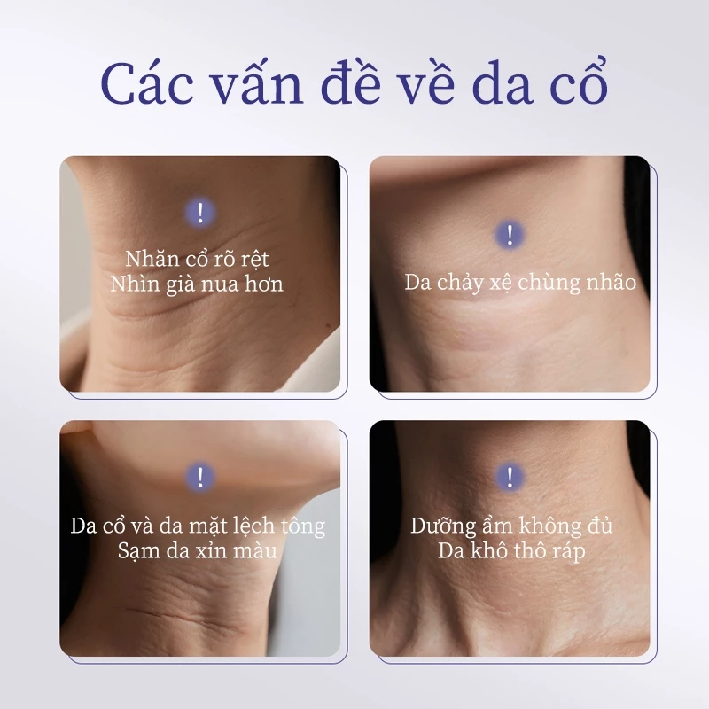 [HÀNG CHÍNH HÃNG] Kem dưỡng da vùng cổ MEDIPEEL sợi naite cao cấp chống lão hóa 100ml