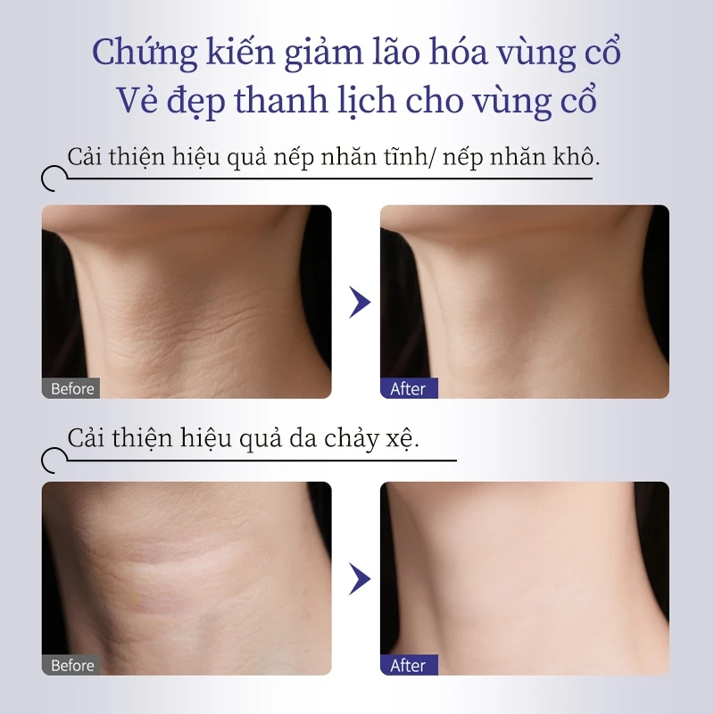[HÀNG CHÍNH HÃNG] Kem dưỡng da vùng cổ MEDIPEEL sợi naite cao cấp chống lão hóa 100ml