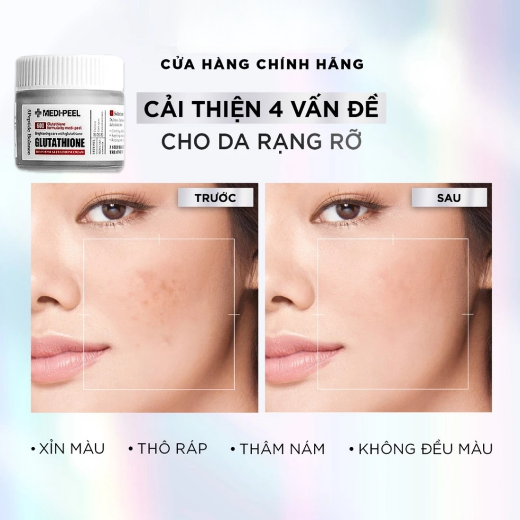 [HÀNG CHÍNH HÃNG] Kem Dưỡng Trắng Da Medipeel Glutathione 600 Dưỡng Trắng Da Mặt Sáng Bật Tông, Ngừa Lão Hóa 50g