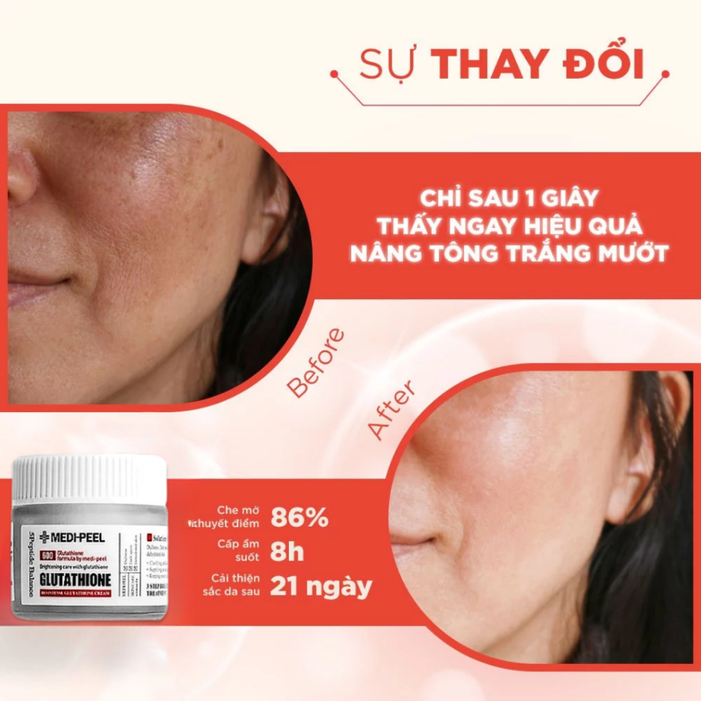 [HÀNG CHÍNH HÃNG] Kem Dưỡng Trắng Da Medipeel Glutathione 600 Dưỡng Trắng Da Mặt Sáng Bật Tông, Ngừa Lão Hóa 50g