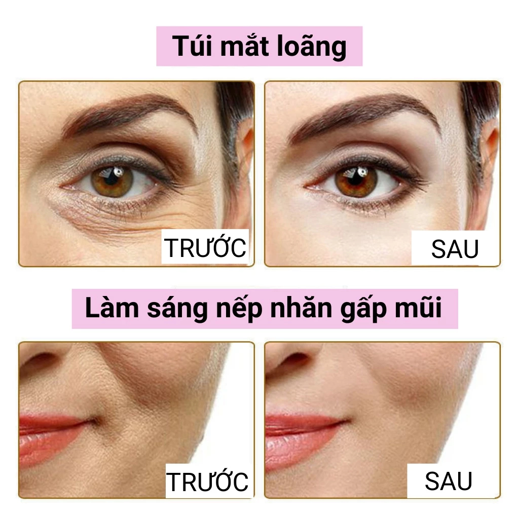 Combo Kem Dưỡng Chống Lão Hóa Và Serum Medipeel Nâng Cơ, Làm Mờ Nếp Nhăn, Duy Trì Làn Da Mềm Mại Da