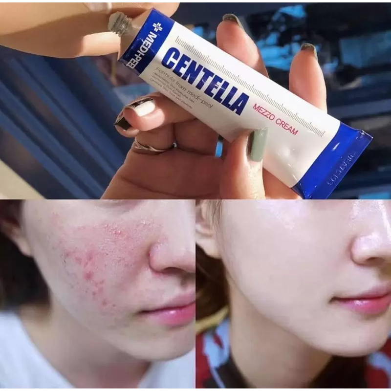 Kem chấm mụn Medi Peel Centella Rau Má Hỗ Trợ Loại Bỏ Mụn, Phục Hồi Da Tuýp 30ml