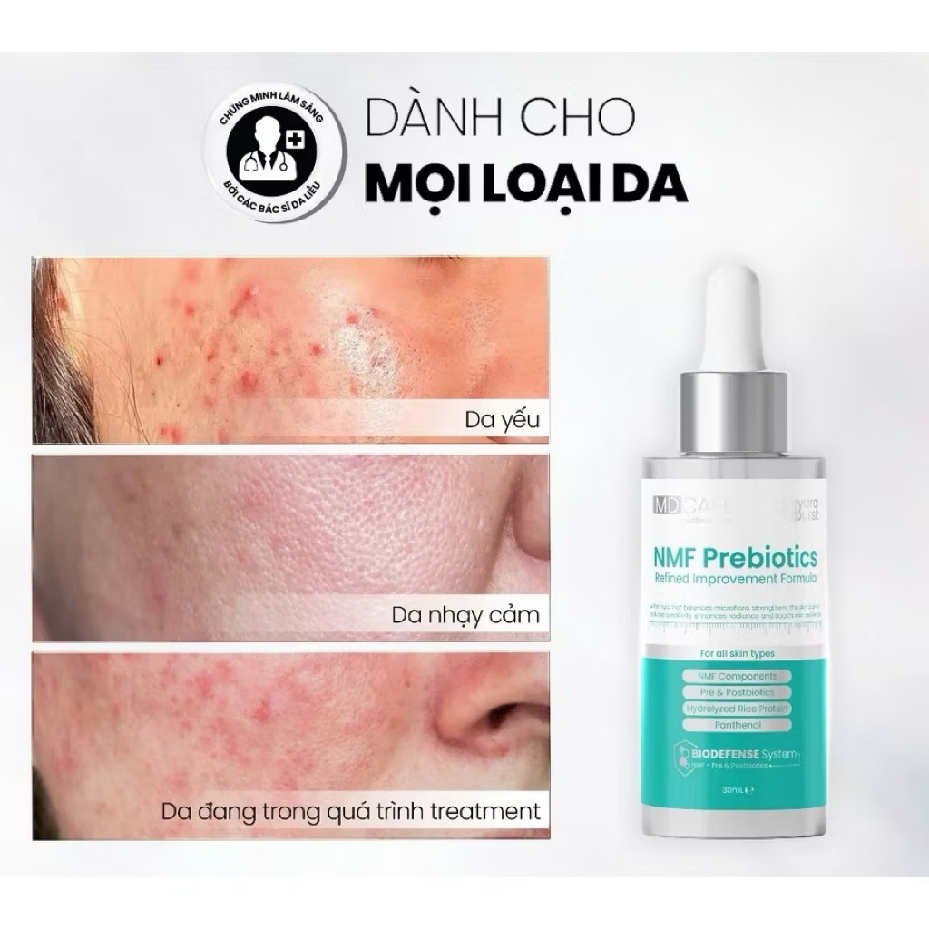 Serum Cân Bằng Lợi Khuẩn Và Phục Hồi Hàng Rào Bảo Vệ Da Md Care Nmf Prebiotics Serum 30Ml - Serum Cân Bằng Lợi Khuẩn ...