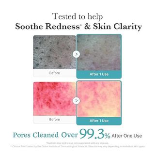 Serum/Sữa rửa mặt MEDICUBE Azelaic Acid Niacinamide