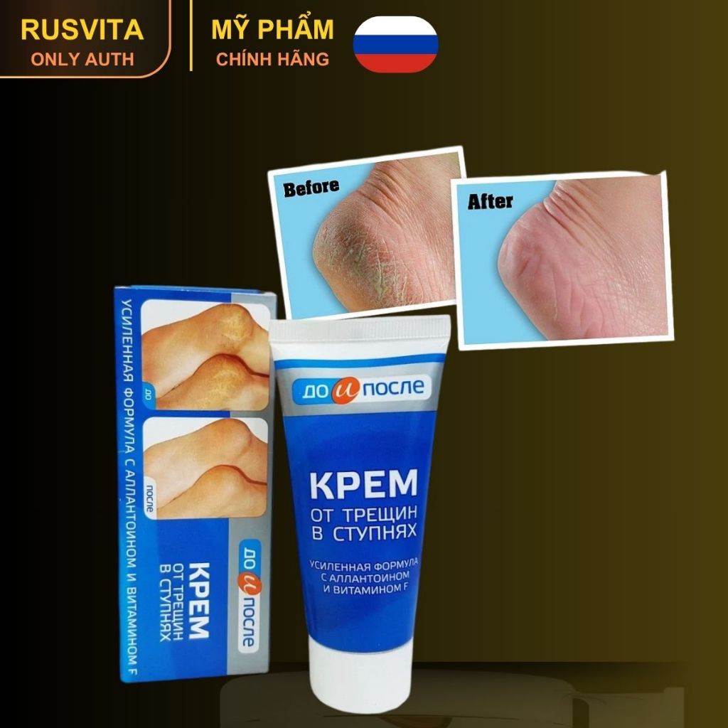 [Kem giảm nứt làm mềm gót chân KPEM nhập khẩu Nga chính hãng] mềm mịn, tăng độ ẩm, bóng da chân 50ml