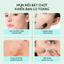 Miếng Dán Mụn Trứng Cá, Miếng Che Mụn Trứng Cá Ngôi Sao Dễ Thương