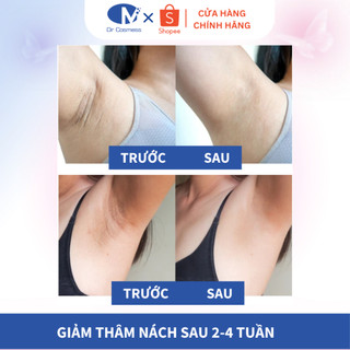 Kem Giảm Thâm Nách Dr Cosmess Dưỡng Trắng Sáng Vùng Da Nách, Khuỷu Tay, Đầu Gối,... 20ml Và 30ml