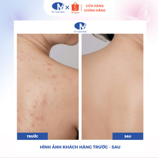 Sữa Tắm AHA BHA Giảm Mụn Lưng, Giảm Viêm Nang Lông, Ngừa Thâm, Ngăn Tuyến Bã Nhờn 300ml Dr Cosmess