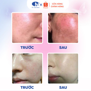 Nước tẩy trang mini size Dr Cosmess 30ml
