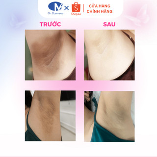 Muối Tẩy Tế Bào Chết Nách Vật Lý Dr Cosmess Giảm Thâm, Làm Sáng, Giảm Mùi, Hương The Mát 100gr