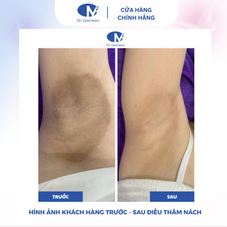 Serum Peel Nách Thâm Blue Peel Dr Cosmess 30ml - Sáng Da, Giảm Thâm Nách Dr Cosmess