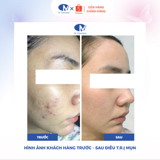 Serum Tẩy Tế Bào Chết Da Mặt AHA BHA Giảm Mụn, Mờ Thâm, Sáng Da Tự Nhiên 40ml Dr Cosmess Chính Hãng