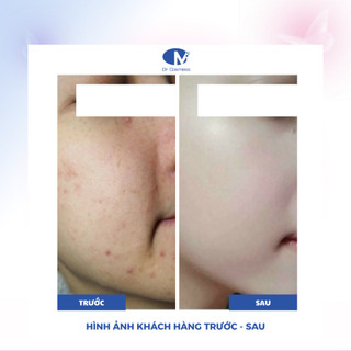Combo 15 Miếng Mặt Nạ Giấy Cystelasma Dr Cosmess, Cấp Ẩm, Phục Hồi  Dưỡng Trắng Da, Mờ Nám Hiệu Quả